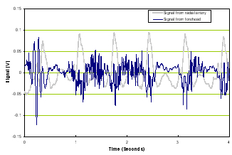 BAM TBI time domain waveform